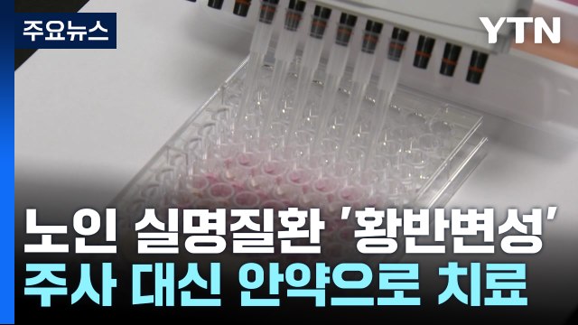 노인 실명 질환 '황반변성' 주사 대신 안약으로 치료 / YTN