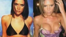 Plastic Surgery Before And After #7