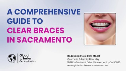 A Comprehensive Guide to Clear Braces in Sacramento