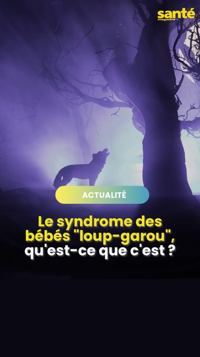 Les bébés loups garous