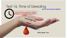 What is time of bleeding?