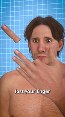 Can You Reattach a Severed Finger?  🤔