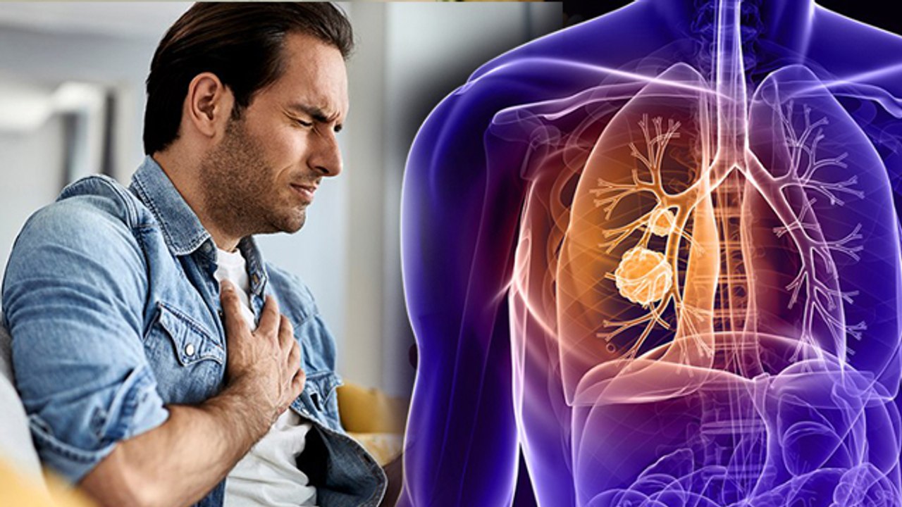 Lump In Lungs Symptoms Hindi: फेफड़ों में गांठ पड़ने पर दिखते है 5 लक्षण, Cancer Or Not | Boldsky