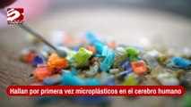 Hallan por primera vez microplásticos en el cerebro humano