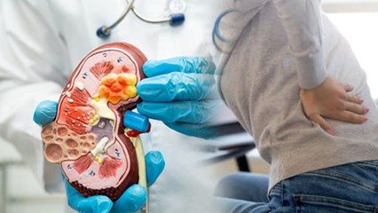 पथरी कब और कैसे बनती हैं | Kidney Stone Reasons And Symptoms...