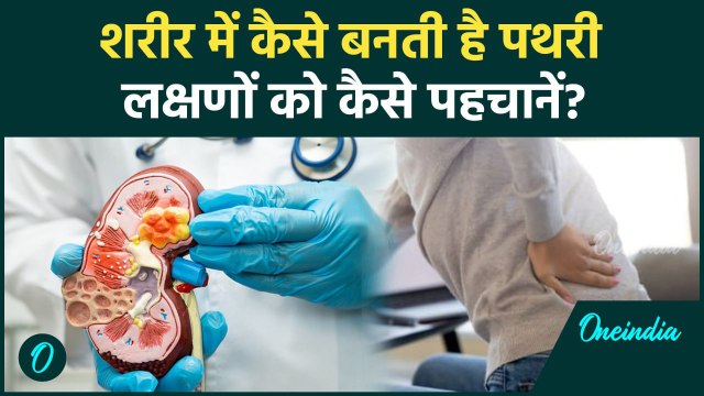 Kidney Stone Reasons : किडनी में पथरी कब और कैसे बनती है, लक्षणों को कैसे पहचानें?