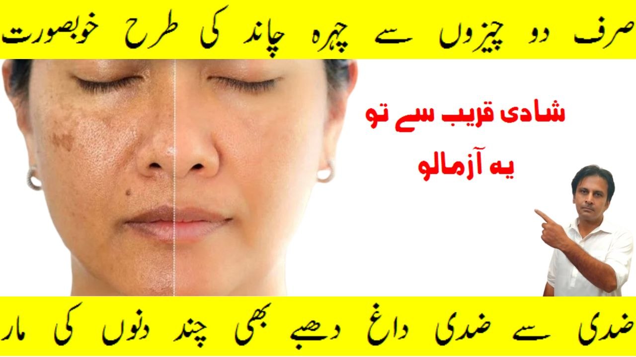 Pigmentation solution on face at home | Home remedy for pigmentation in Hindi | Arshad health and beauty tips