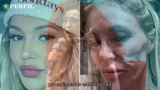 Modelo tem rosto derretido, Taís Araújo revela reação e Beatriz provoca caos em 'Garota do Momento'