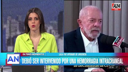 Lula da Silva se recupera tras la operación de emergencia por un hematoma intracraneal