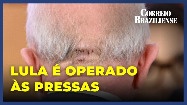 Presidente Lula é operado às pressas em São Paulo após sentir dores de cabeça