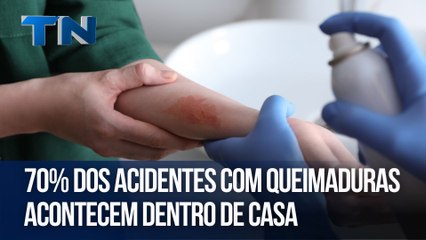 70% dos acidentes com queimaduras acontecem dentro de casa | Cuide-se Bem!
