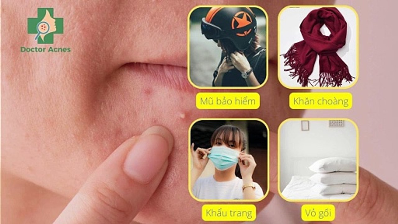 Mụn bọc ở cằm: nguyên nhân, cách điều trị hiệu quả