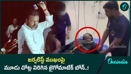 మోహన్ బాబు దాడిలో తీవ్రంగా గాయపడిన జర్నలిస్ట్..! | Oneindia Telugu