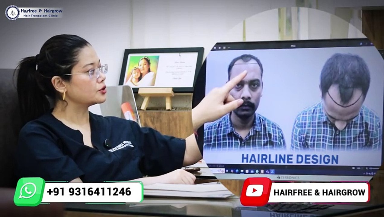Hair Transplant in Kolkata | Amazing Hair Transplant Results & Best Hair Transplant Cost in Kolkata