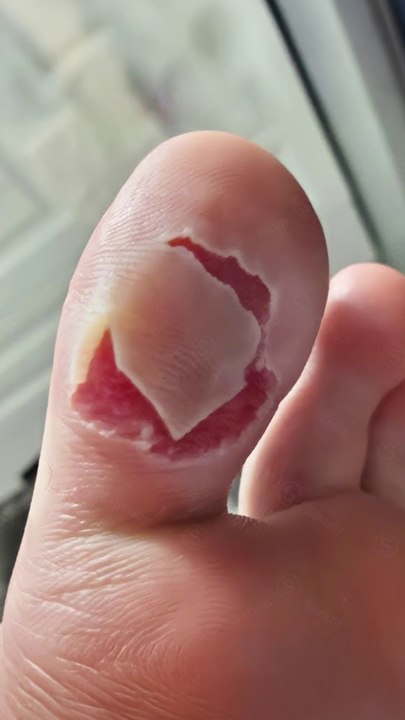 Nicht ZUCKEN Challenge EXTREM!