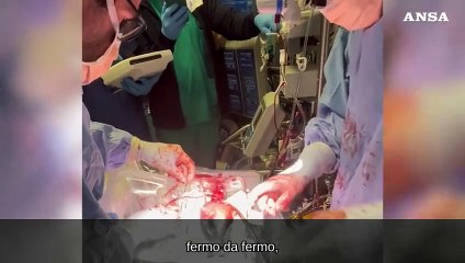 Padova, primo trapianto al mondo a cuore totalmente battente