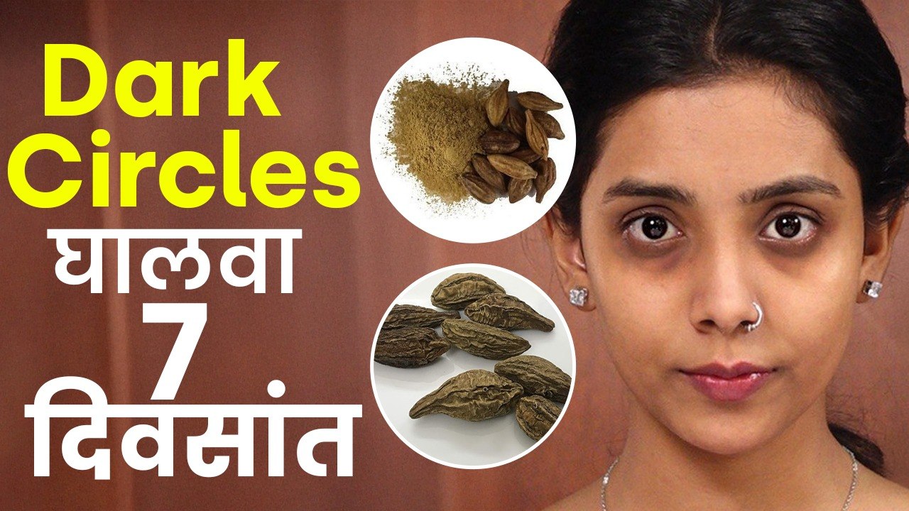 Dark Circles घालवण्यासाठी सोपा उपाय | Home Remedies For Dark Circles | Get Rid Of Dark Circles