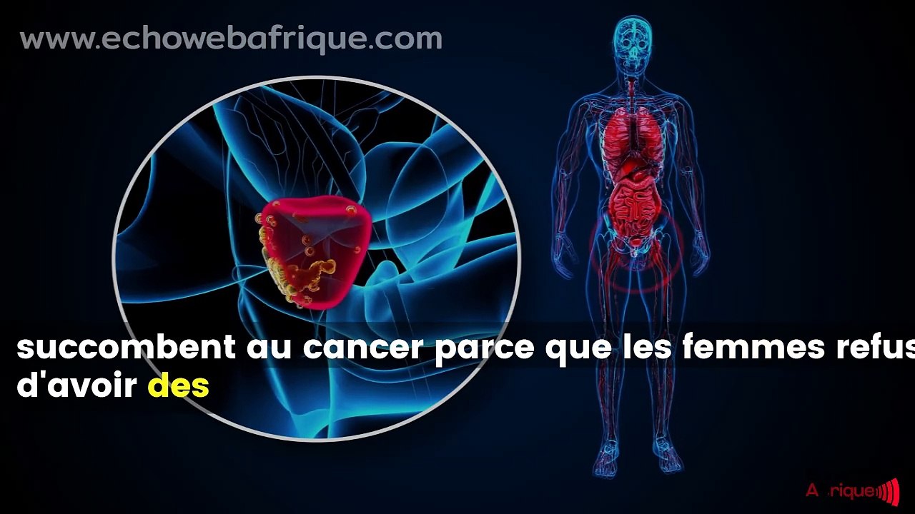 « De nombreux hommes meurent du cancer de la prostate parce que … »