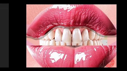 3rd Try Dental Deep