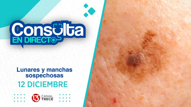 12 Diciembre 2024 | Consulta en Directo - Lunares y manchas sospechosas