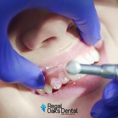 Reveal a Whiter, More Confident Smile with Teeth Whitening