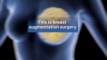 How breast enlargement surgery is carried out