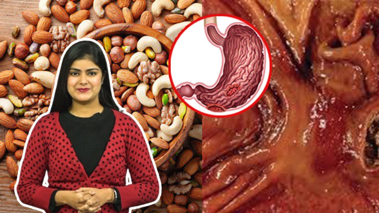 Daily Dry Fruits Khane Se Kya Hota Hai| ड्राई फ्रूट्स खाने के नुकसान |Diabetes To Sudden Weight Gain