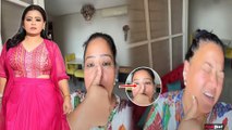 Bharti Singh के साथ हुआ हादसा, तकलीफ में देख Fans हुए परेशान, बोले, 'Please अपना ध्यान...'