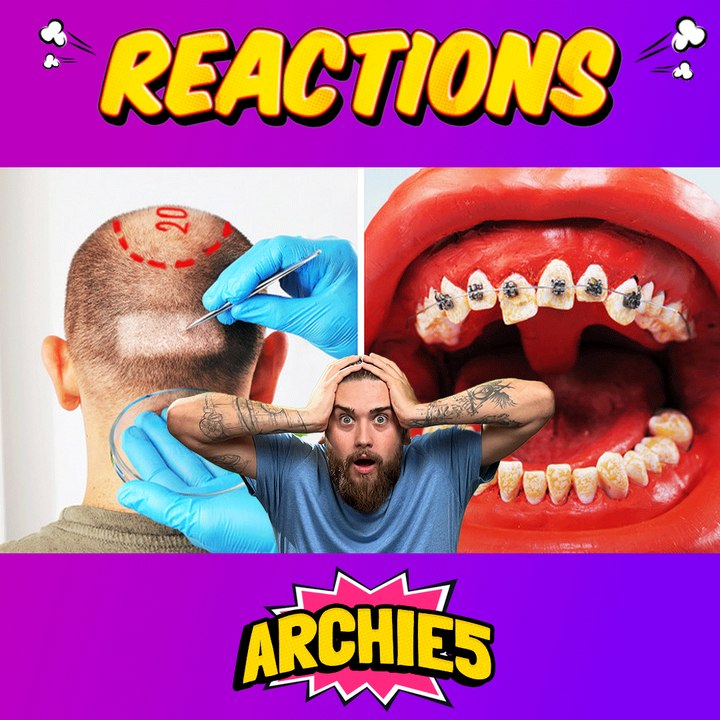 🤔 Did You Know This About C-Sections? The Dudes REACT!