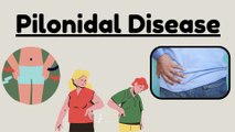 Pilonidal Disease: Comprehensive Overview, Causes, Symptoms, and Management | Novice Medic