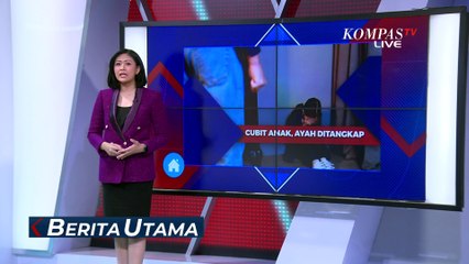 Ayah Diperiksa Polisi Karena Cubiti Anak Kandung Berulang Kali, Terancam Hukuman 3 Tahun Penjara