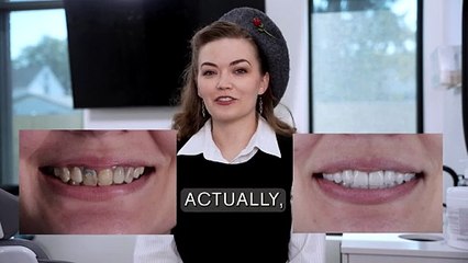 405 Dental Aesthetics: Patient Testimonial Mary