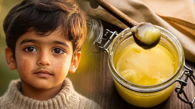 Sardi Me Gal Fat Jaye To Kya Kare | सर्दी में गाल फट जाएं तो क्या करें | Boldsky