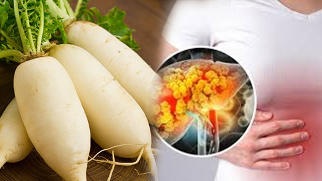 Fatty Liver Me Muli Khana Chahiye Ya Nahi | फैटी लिवर में क्या खाना चाहिए | Radish Benefits In Hindi