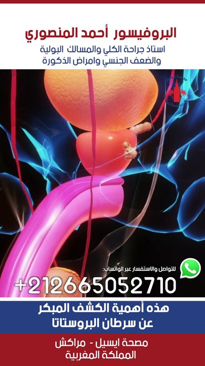 هذه أهمية الكشف المبكر عن سرطان البروستاتا #urology #الانتصاب #urologue #البروفيسور_احمد_المنصوري #ذكور #doctor #instahealth #سرطان_البروستاتا #علاج #الضعف_الجنسي #البروستاتا #سرعة_القذف #casablanca #النحافة #morocco