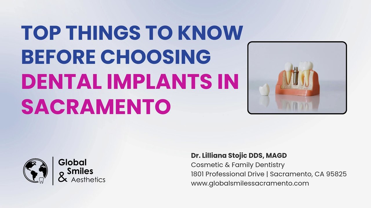 Top Things to Know Before Choosing Dental Implants in Sacramento