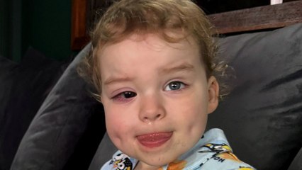 Toddler blind in one eye after falling over while learning to walk at nursery