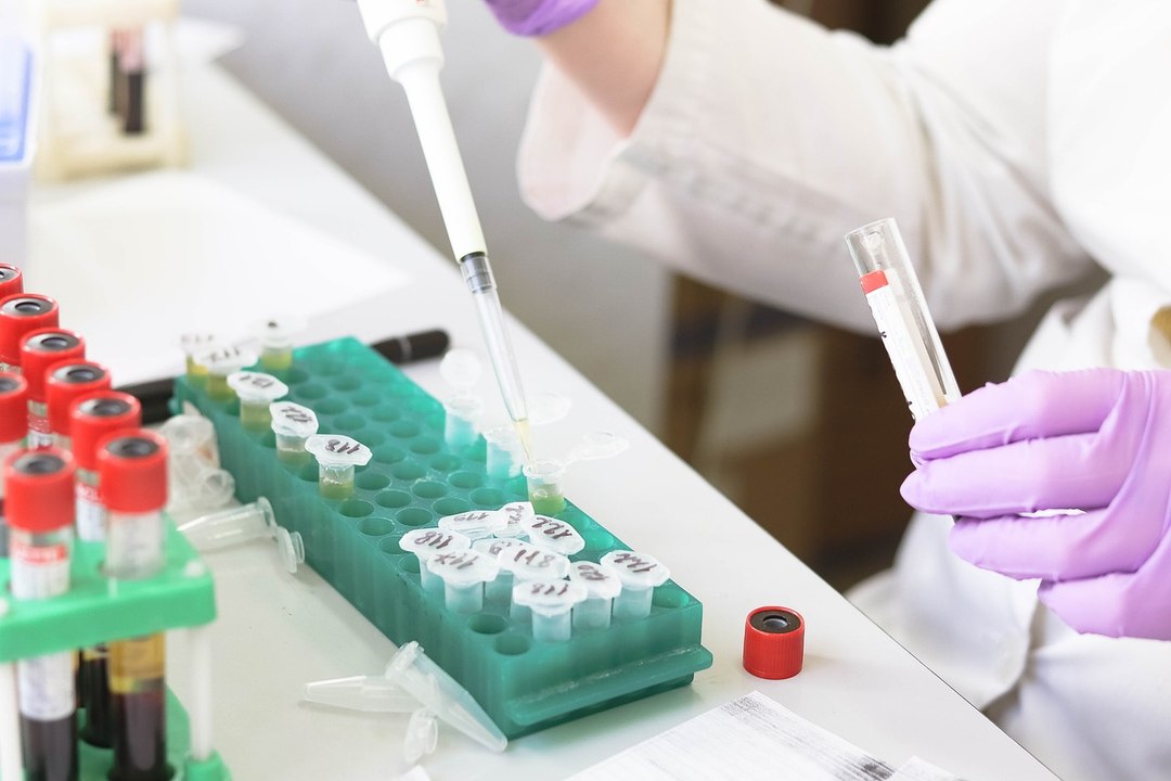 AHF Panamá ayuda a detectar el VIH de manera gratuita