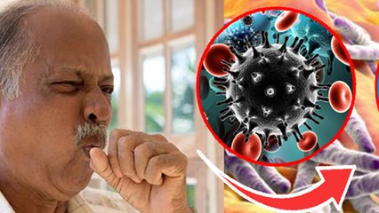 Tuberculosis Causes: टीबी क्यों और कैसे होता है, Symptoms In Hindi | Boldsky