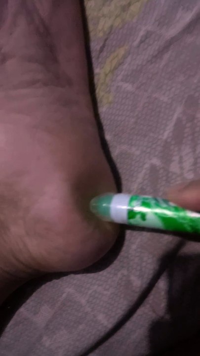 Pegel kaki , pijit dah
