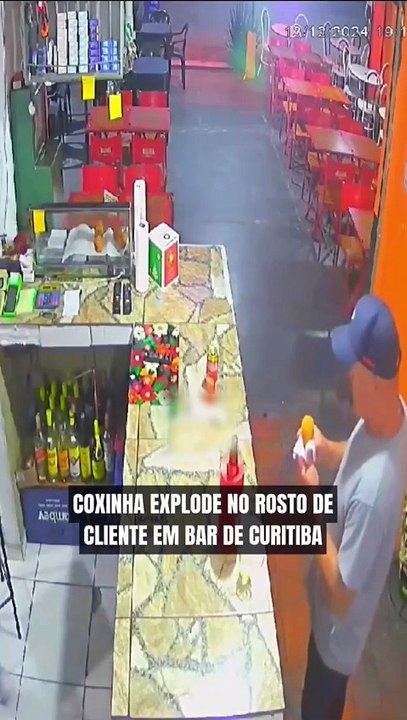 Coxinha explode no rosto de um homem