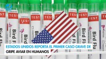 Estados Unidos reporta el primer caso grave de gripe aviar en humanos