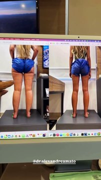 Yasmin Brunet surpreende a web ao mostrar antes e depois do corpo após perder quase 15kg de gordura