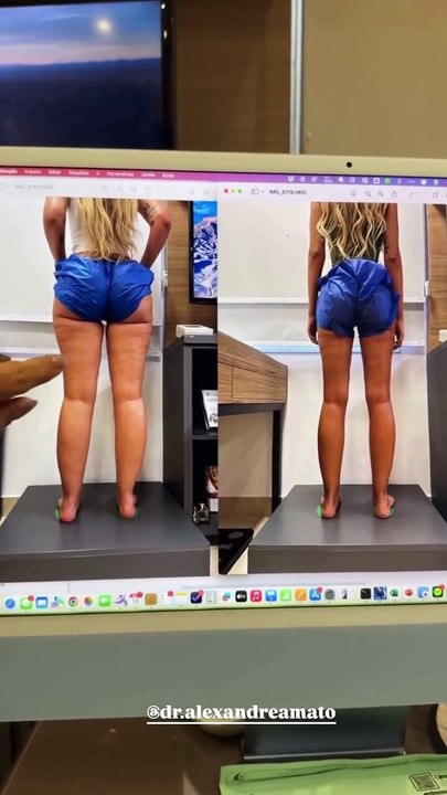 Yasmin Brunet surpreende a web ao mostrar antes e depois do corpo após perder quase 15kg de gordura