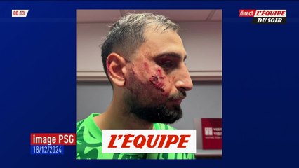 Des examens pour Donnarumma - Foot - L1 - PSG