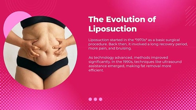 Shaping the Future Innovations in Liposuction Treatments