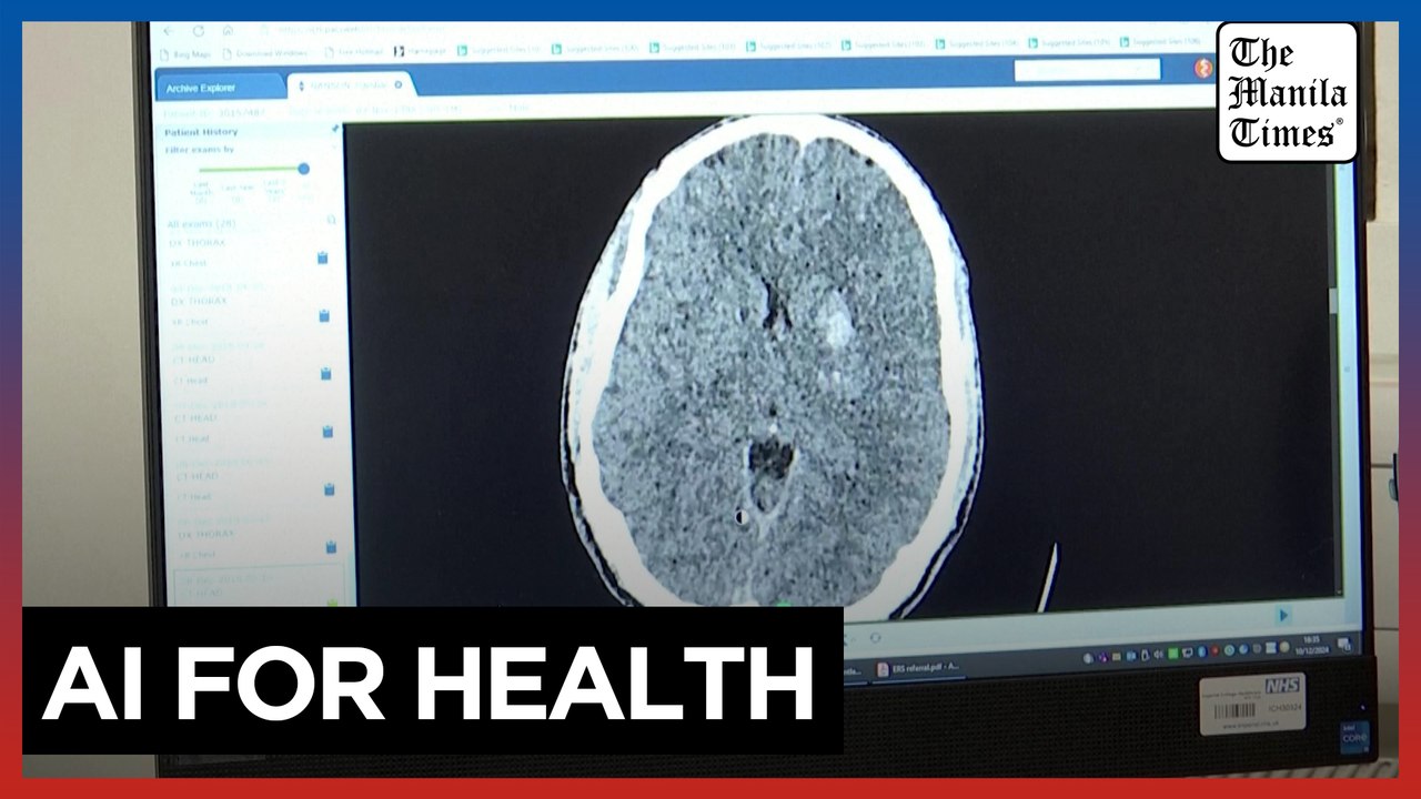 New AI software doubles stroke diagnosis accuracy