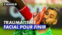 «Traumatisme facial avec de multiples plaies» pour Donnarumma