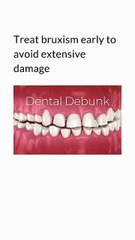 Teeth Grinding #viral