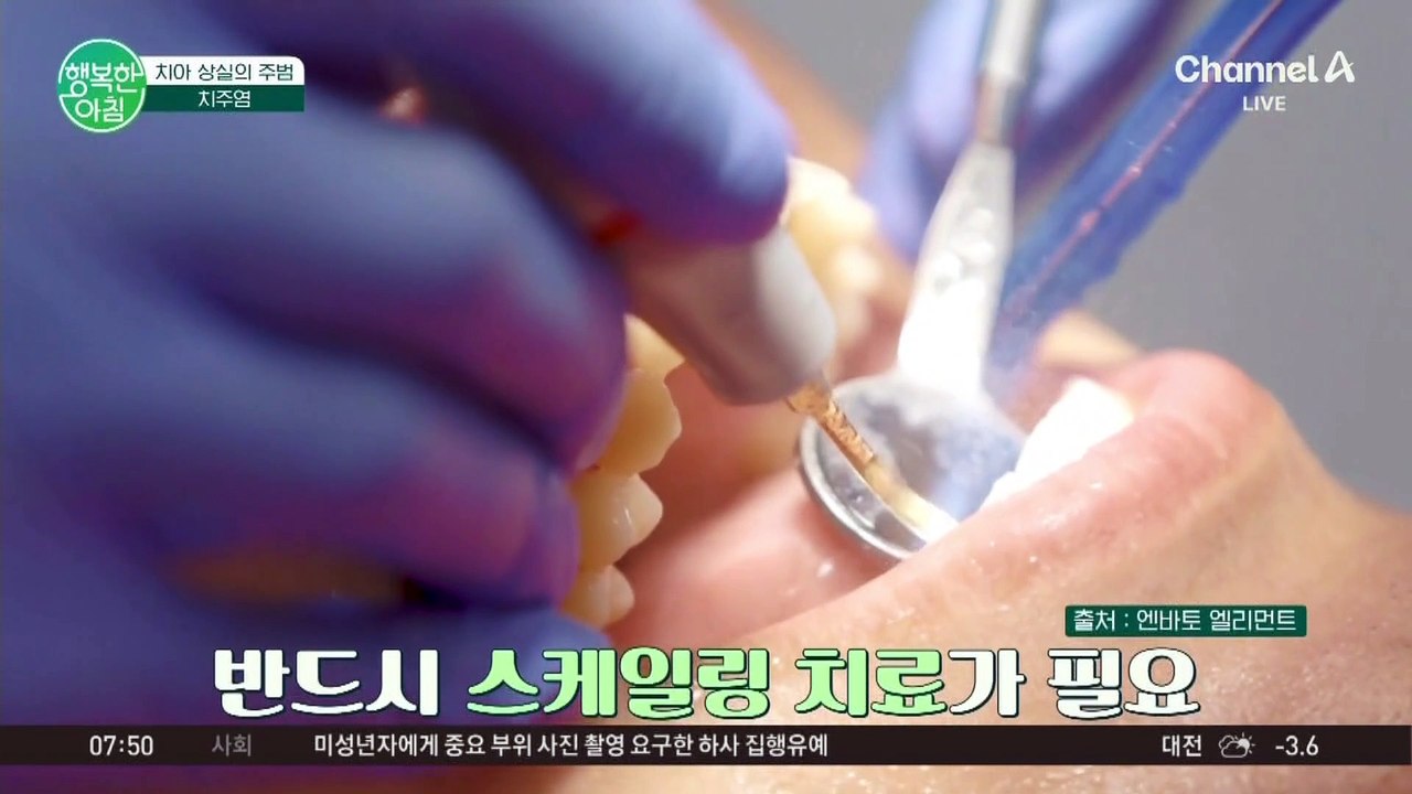 [닥터하우스] 치아 상실의 주범, 치주염♨ 흔한 치태와 치주가 원인이 된다?! #치주염